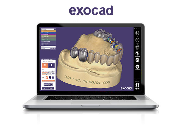 Exocad DentalCAD